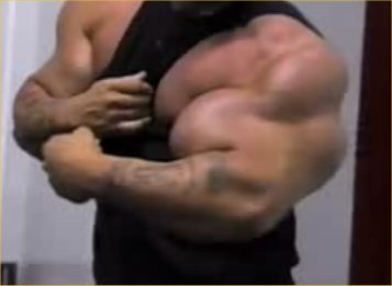 Biceps Strasni