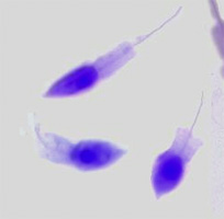 Choanoflagellate