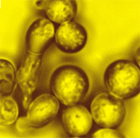 Blastomyces