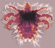 Pthirus
