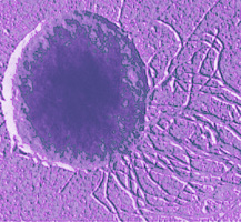Methanococcus