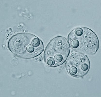 Myxobolus