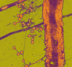 arbuscular Glomeromycete