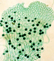 Leptosporangiate