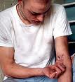 A Junkie