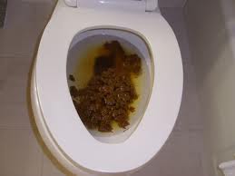 poo