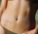 Navel 4