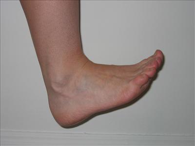 Bullet in the foot