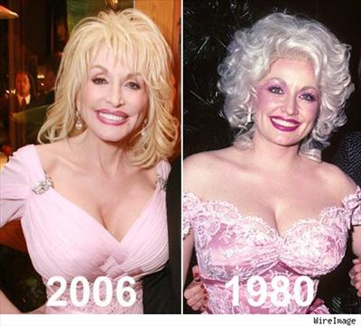 Dolly Then and Now