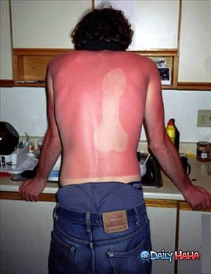 SunBurn Prank