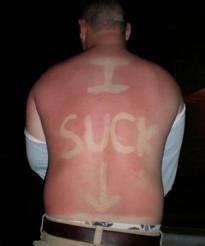 SunBurn Prank 2