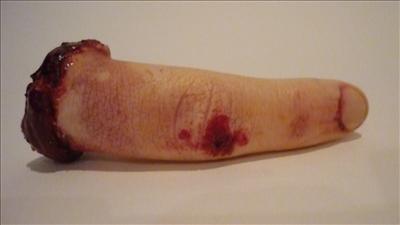 severed finger