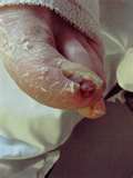 Toenails