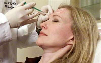 BOTOX