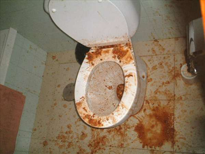 Vomit
