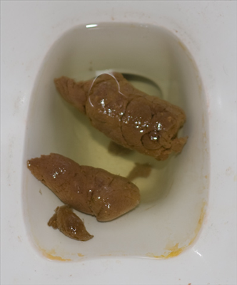 Poop