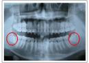 X-ray เห็นกัน...จะๆ
